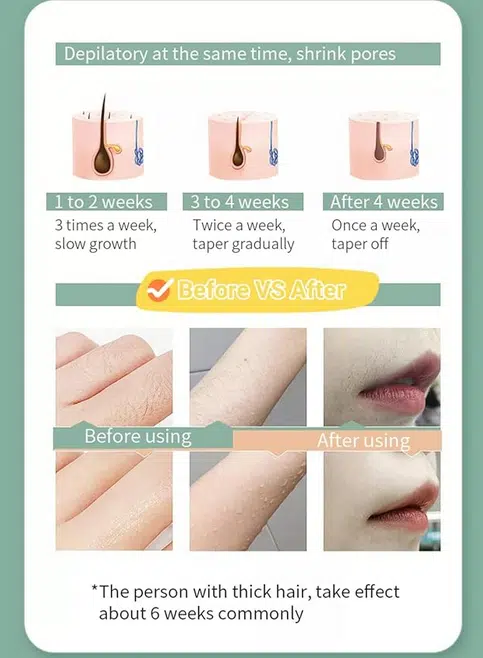 Αποτριχωτική Μηχανή Παλμικού Φωτός με 5 Επίπεδα Έντασης Αποτριχωτική Μηχανή Παλμικού Φωτός με 5 Επίπεδα Έντασης