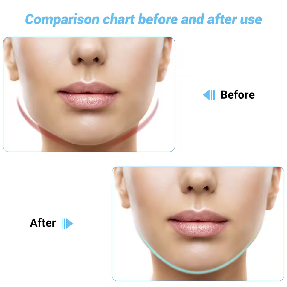 EMS Συσκευή Lifting Προσώπου & Σαγονιού με Δόνηση, LED & Θερμότητα EMS Συσκευή Lifting Προσώπου & Σαγονιού με Δόνηση, LED & Θερμότητα