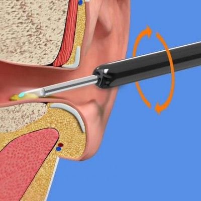 Επαναφορτιζόμενο Αδιάβροχο Ωτοσκόπιο WiFi με Κάμερα 1080 FHD και Εφαρμογή για Smartphone - Type C Επαναφορτιζόμενο Αδιάβροχο Ωτοσκόπιο WiFi με Κάμερα 1080 FHD και Εφαρμογή για Smartphone - Type C