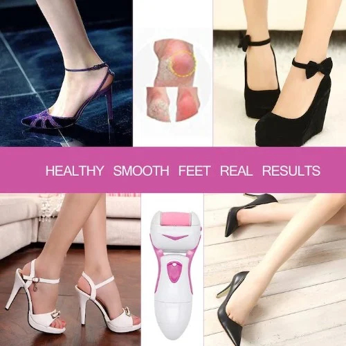 Ηλεκτρική Λίμα Ποδιών Hoomei – Επαναφορτιζόμενη Wet και Dry με LED και Περιστρεφόμενη Κεφαλή 360° Ηλεκτρική Λίμα Ποδιών Hoomei – Επαναφορτιζόμενη Wet και Dry με LED και Περιστρεφόμενη Κεφαλή 360°