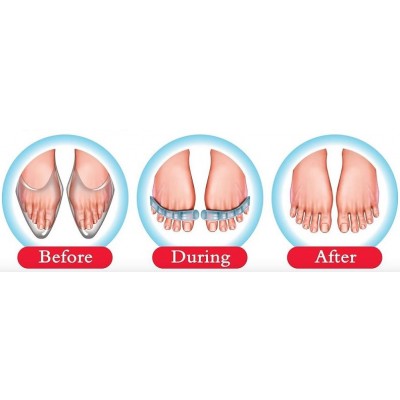 Ορθοπεδικά Διαχωριστικά Gel Μασάζ Δακτύλων Flex-Feet (2 Τεμάχια) Ορθοπεδικά Διαχωριστικά Gel Μασάζ Δακτύλων Flex-Feet (2 Τεμάχια)