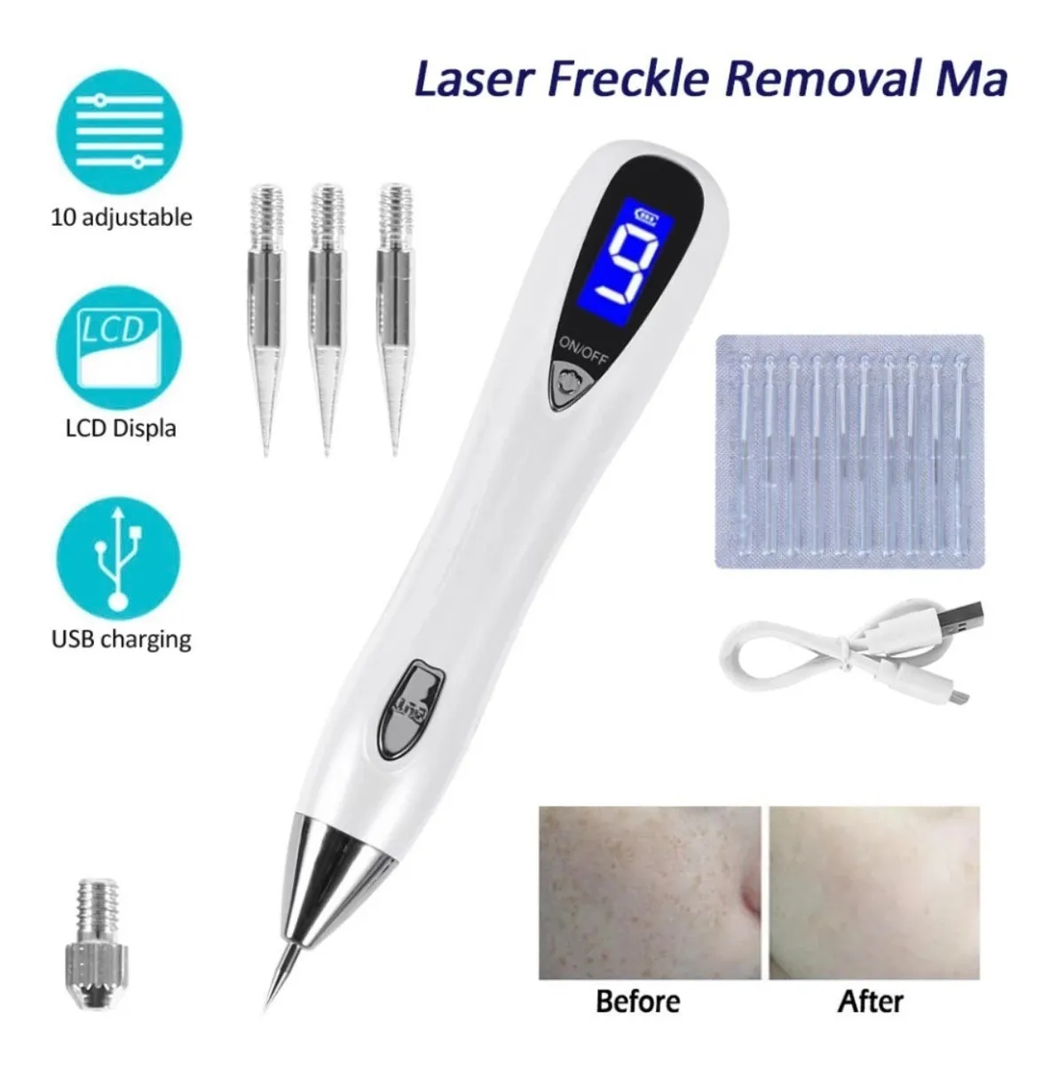 Ψηφιακό Plasma Pen για Σπίλους, Κηλίδες & Τατουάζ - 9 Επίπεδα Ισχύος με LCD Οθόνη & Φωτισμό Ψηφιακό Plasma Pen για Σπίλους, Κηλίδες & Τατουάζ - 9 Επίπεδα Ισχύος με LCD Οθόνη & Φωτισμό