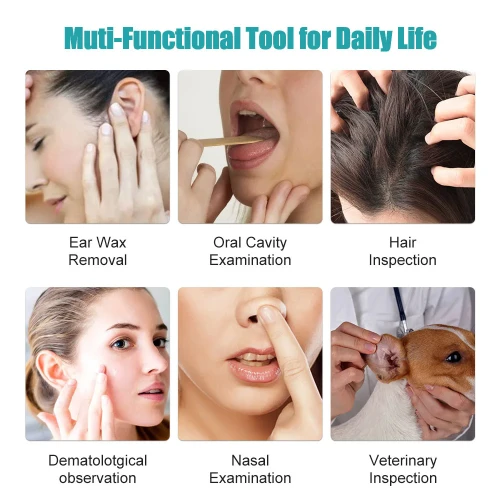 Εργαλείο αφαίρεσης κεριού αυτιού με κάμερα HD και καθαριστικό αυτιού με 6 φώτα LED – Λευκό Εργαλείο αφαίρεσης κεριού αυτιού με κάμερα HD και καθαριστικό αυτιού με 6 φώτα LED – Λευκό