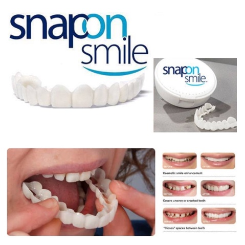 Snap On Smile - Μασελάκι Μεταμόρφωσης Χαμόγελου - Αφαιρούμενη Οδοντική Όψη Ρητίνης για Άνω ή Κάτω Γνάθο Snap On Smile - Μασελάκι Μεταμόρφωσης Χαμόγελου - Αφαιρούμενη Οδοντική Όψη Ρητίνης για Άνω ή Κάτω Γνάθο