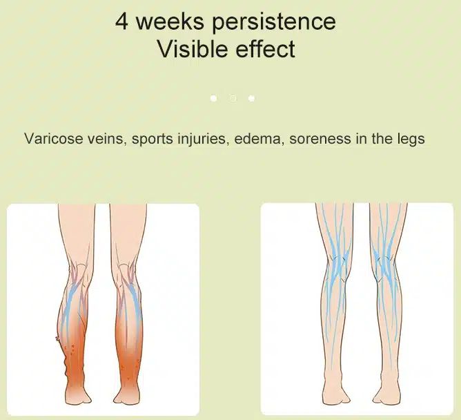 Συσκευή Λεμφικού Μασάζ Πρεσσοθεραπείας Κάτω Άκρων 2 Εντάσεων Συσκευή Λεμφικού Μασάζ Πρεσσοθεραπείας Κάτω Άκρων 2 Εντάσεων