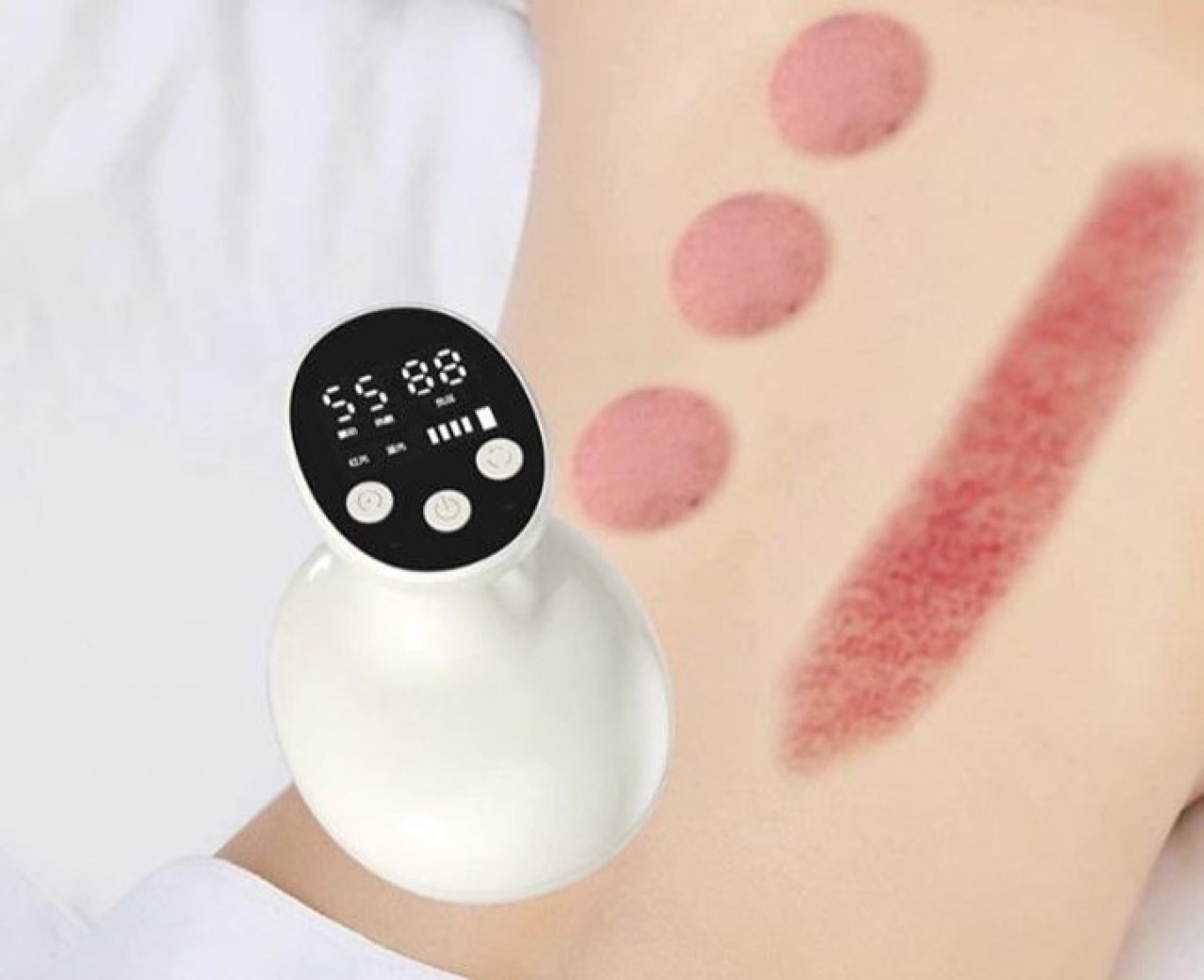 Συσκευή Μασάζ Κατά της Κυτταρίτιδας με Αναρρόφηση & Υπέρυθρες Συσκευή Μασάζ Κατά της Κυτταρίτιδας με Αναρρόφηση & Υπέρυθρες