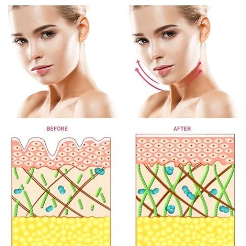 Συσκευή Περιποίησης - Μασάζ Προσώπου για Αντιγήρανση Mini Facial Toning Device Συσκευή Περιποίησης - Μασάζ Προσώπου για Αντιγήρανση Mini Facial Toning Device